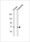 Abelson Helper Integration Site 1 antibody, LS-C392838, Lifespan Biosciences, Western Blot image 