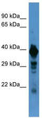 Chromaffin granule amine transporter antibody, TA344468, Origene, Western Blot image 