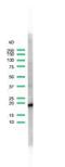 CD3d Molecule antibody, GTX16669, GeneTex, Western Blot image 