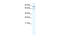 Poly(A)-Specific Ribonuclease antibody, 28-665, ProSci, Enzyme Linked Immunosorbent Assay image 