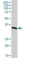 GIPC PDZ Domain Containing Family Member 2 antibody, H00054810-B01P, Novus Biologicals, Western Blot image 