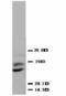 Placental Growth Factor antibody, LS-C171825, Lifespan Biosciences, Western Blot image 
