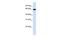 Leiomodin 1 antibody, GTX45370, GeneTex, Western Blot image 