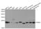 Proteasome Subunit Beta 4 antibody, A5697, ABclonal Technology, Western Blot image 