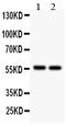 Aldehyde Dehydrogenase 2 Family Member antibody, PB9472, Boster Biological Technology, Western Blot image 