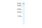 LIM Domain And Actin Binding 1 antibody, 28-124, ProSci, Enzyme Linked Immunosorbent Assay image 