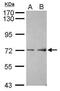 Amiloride-sensitive cation channel 4 antibody, PA5-30649, Invitrogen Antibodies, Western Blot image 