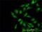 WASP Like Actin Nucleation Promoting Factor antibody, H00008976-M04, Novus Biologicals, Immunofluorescence image 
