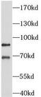 Adaptor Related Protein Complex 1 Subunit Gamma 2 antibody, FNab00458, FineTest, Western Blot image 