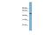 Actin Related Protein 3B antibody, PA5-44774, Invitrogen Antibodies, Western Blot image 