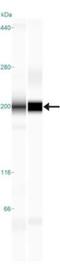 Toll Like Receptor 8 antibody, GTX12120, GeneTex, Western Blot image 