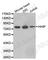 Hedgehog Interacting Protein antibody, A3260, ABclonal Technology, Western Blot image 