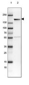Neurofilament Medium antibody, NBP2-46625, Novus Biologicals, Western Blot image 