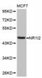 Nuclear Receptor Subfamily 1 Group I Member 2 antibody, abx126274, Abbexa, Western Blot image 