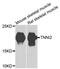 Troponin I2, Fast Skeletal Type antibody, PA5-76303, Invitrogen Antibodies, Western Blot image 