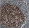 MCL1 Apoptosis Regulator, BCL2 Family Member antibody, NBP2-52968, Novus Biologicals, Immunohistochemistry paraffin image 