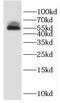 Dihydrouridine Synthase 1 Like antibody, FNab02559, FineTest, Western Blot image 