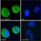 Calcium/Calmodulin Dependent Protein Kinase II Alpha antibody, GTX88413, GeneTex, Immunofluorescence image 