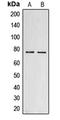 Collagen Type XVIII Alpha 1 Chain antibody, LS-C353586, Lifespan Biosciences, Western Blot image 