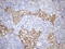 Cell Proliferation Regulating Inhibitor Of Protein Phosphatase 2A antibody, LS-C794375, Lifespan Biosciences, Immunohistochemistry paraffin image 