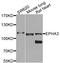 EPH Receptor A3 antibody, STJ110712, St John