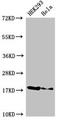 Ribonuclease H2 Subunit C antibody, LS-C672492, Lifespan Biosciences, Western Blot image 