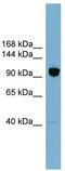Oxysterol Binding Protein Like 8 antibody, TA335309, Origene, Western Blot image 