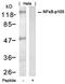 Nuclear Factor Kappa B Subunit 1 antibody, orb14685, Biorbyt, Western Blot image 