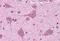Acyl-CoA Synthetase Long Chain Family Member 4 antibody, GTX89766, GeneTex, Immunohistochemistry paraffin image 