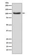 MutS Homolog 2 antibody, M00140, Boster Biological Technology, Western Blot image 