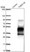 Transmembrane Protein 139 antibody, PA5-57898, Invitrogen Antibodies, Western Blot image 