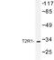 Taste 2 Receptor Member 1 antibody, LS-C177307, Lifespan Biosciences, Western Blot image 