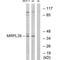 Mitochondrial Ribosomal Protein L39 antibody, PA5-50062, Invitrogen Antibodies, Western Blot image 