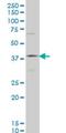 Homeobox D11 antibody, H00003237-M03, Novus Biologicals, Western Blot image 