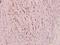 Protein Kinase, DNA-Activated, Catalytic Subunit antibody, A00645Y2609, Boster Biological Technology, Immunohistochemistry paraffin image 
