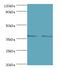 Mitogen-Activated Protein Kinase Kinase 3 antibody, MBS1496609, MyBioSource, Western Blot image 
