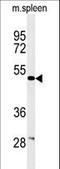 Coronin 6 antibody, LS-B9286, Lifespan Biosciences, Western Blot image 