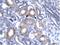 MAPK Activated Protein Kinase 2 antibody, 31-146, ProSci, Immunohistochemistry paraffin image 