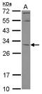 Potassium Channel Tetramerization Domain Containing 4 antibody, LS-C155585, Lifespan Biosciences, Western Blot image 