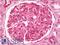 Bone Marrow Stromal Cell Antigen 2 antibody, LS-B8015, Lifespan Biosciences, Immunohistochemistry paraffin image 