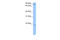 Actin Related Protein 2/3 Complex Subunit 3 antibody, 30-793, ProSci, Enzyme Linked Immunosorbent Assay image 