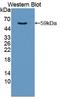 Aryl Hydrocarbon Receptor antibody, LS-C374111, Lifespan Biosciences, Western Blot image 