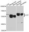 Catalase antibody, A5275, ABclonal Technology, Western Blot image 