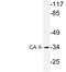 Carbonic Anhydrase 2 antibody, LS-C291678, Lifespan Biosciences, Western Blot image 