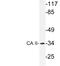 Carbonic anhydrase C antibody, LS-C291678, Lifespan Biosciences, Western Blot image 