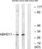 Abhydrolase Domain Containing 11 antibody, LS-C119675, Lifespan Biosciences, Western Blot image 