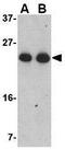 GST3 antibody, GTX31766, GeneTex, Western Blot image 