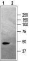 Gamma-Aminobutyric Acid Type A Receptor Alpha2 Subunit antibody, TA328810, Origene, Western Blot image 