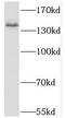 KIT antibody, FNab09971, FineTest, Western Blot image 