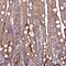 Transmembrane Channel Like 5 antibody, HPA042037, Atlas Antibodies, Immunohistochemistry paraffin image 